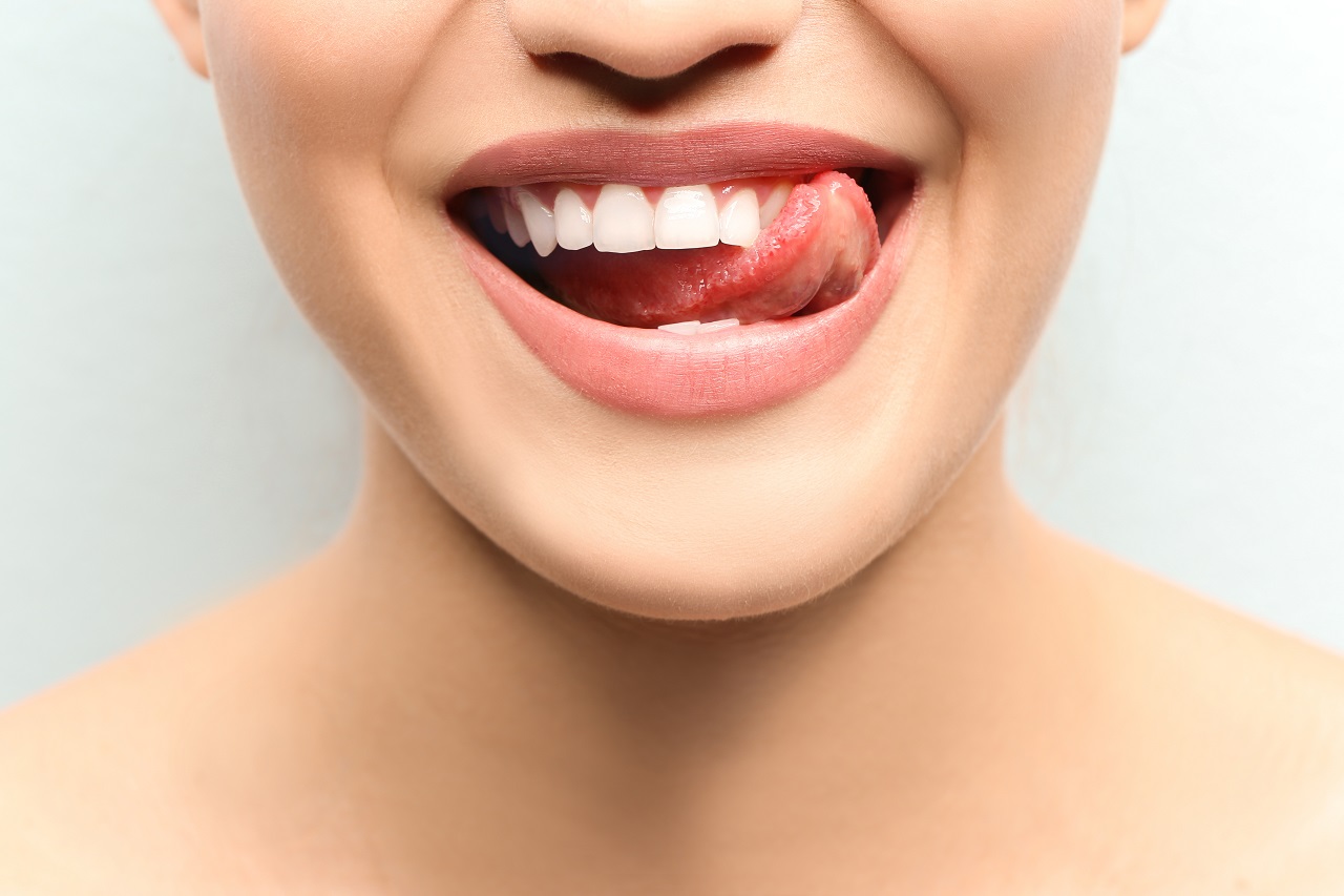 Wybielanie zębów – na czym polega?
